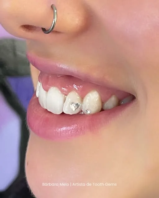 Pormenor de um sorriso com tooth gems